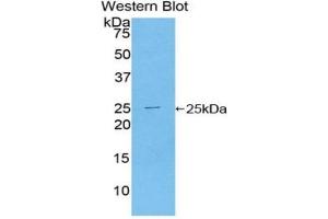 Western blot analysis of the recombinant protein. (TICAM2 antibody  (AA 34-241))