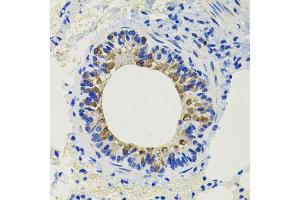 Immunohistochemistry of paraffin-embedded mouse lung using CALB2 antibody at dilution of 1:100 (x40 lens). (Calretinin antibody)