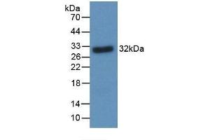Detection of Recombinant BDNF using Monoclonal Antibody to Brain Derived Neurotrophic Factor (BDNF) (BDNF antibody  (AA 20-252))
