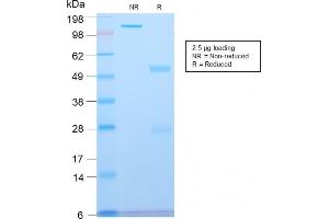 SDS-PAGE (SDS) image for anti-Spectrin, Beta, Non-erythrocytic 2 (SPTBN2) (AA 356-475) antibody (ABIN6940656)