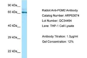 Western Blotting (WB) image for anti-Phosphoglucomutase 2 (PGM2) (C-Term) antibody (ABIN2774378) (Phosphoglucomutase 2 antibody  (C-Term))