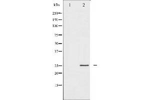 Western blot analysis of p21 Cip1 expression in EGF treated HeLa whole cell lysates,The lane on the left is treated with the antigen-specific peptide. (p21 antibody  (C-Term))