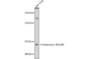 Western blot analysis of extracts of Rat lung, using Osteocalcin (BGLAP) antibody (ABIN6134565, ABIN6137546, ABIN6137547 and ABIN6221793) at 1:1000 dilution. (Osteocalcin antibody  (AA 1-100))