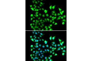 Immunofluorescence analysis of MCF-7 cells using SNRPD2 antibody. (SNRPD2 antibody)