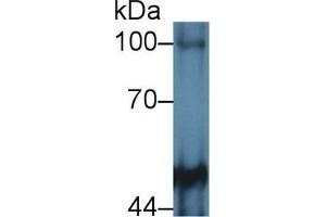 Western blot analysis of Mouse Cerebrum lysate, using Human PTPRM Antibody (2 µg/ml) and HRP-conjugated Goat Anti-Rabbit antibody ( (PTPRM antibody  (AA 1197-1403))