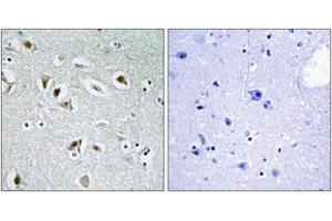 Immunohistochemistry analysis of paraffin-embedded human brain tissue, using CDKA2 Antibody. (CDK2AP2 antibody  (AA 51-100))