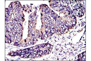 Immunohistochemistry (IHC) image for anti-V-Crk Sarcoma Virus CT10 Oncogene Homolog (Avian) (CRK) antibody (ABIN969062)