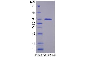 SDS-PAGE analysis of Human GBP1 Protein. (GBP1 Protein)