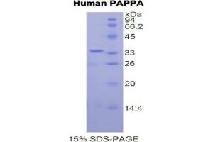 SDS-PAGE analysis of Human PAPPA Protein. (PAPPA Protein)