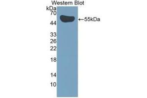 Detection of Recombinant IL35, Human using Polyclonal Antibody to Interleukin 35 (IL35) (Interleukin 35 antibody  (AA 23-219))