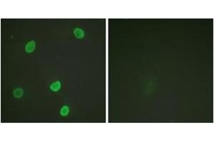 Immunofluorescence (IF) image for anti-Histone H4 (acLys8) antibody (ABIN2890733) (Histone H4 antibody  (acLys8))