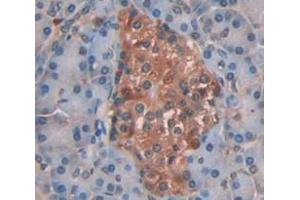 IHC-P analysis of Human Tissue, with DAB staining. (MTR antibody  (AA 923-1265))