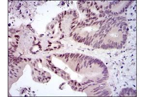 Immunohistochemistry (IHC) image for anti-c-Fos (c-Fos) antibody (ABIN969150)