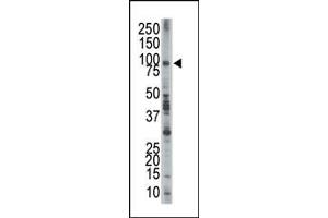 Western Blotting (WB) image for anti-Epidermal Growth Factor Receptor Pathway Substrate 8 (EPS8) (AA 9-39), (N-Term) antibody (ABIN392773)