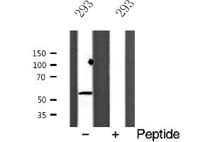 Western blot analysis of ACV1B expression in 293 cells (Activin A Receptor Type IB/ALK-4 antibody  (Internal Region))