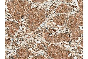 Immunohistochemistry analysis using Rabbit Anti-ROR1 Polyclonal Antibody (ABIN5667786). (ROR1 antibody  (AA 200-300) (Atto 594))