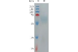 Human T Protein, hFc Tag on SDS-PAGE under reducing condition. (TMEM219 Protein (Fc Tag))