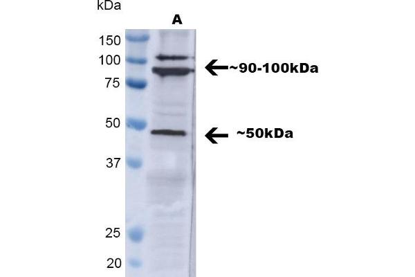 TNFRSF1A antibody  (AA 20-43) (FITC)