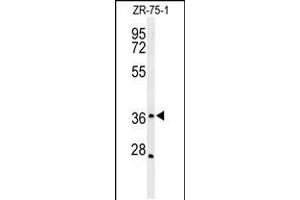 Western blot analysis of MIIP Antibody in ZR-75-1 cell line lysates (35ug/lane) (MIIP antibody  (C-Term))