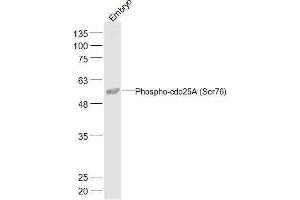 Mouse Embryo lysates probed with Phospho-cdc25A (Ser76) Polyclonal Antibody, Unconjugated  at 1:500 dilution and 4˚C overnight incubation. (CDC25A antibody  (pSer76))