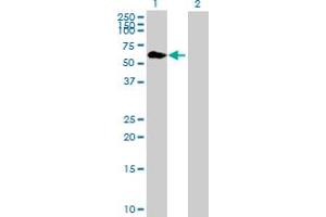Western Blot analysis of TRIM8 expression in transfected 293T cell line by TRIM8 MaxPab polyclonal antibody. (TRIM8 antibody  (AA 1-551))