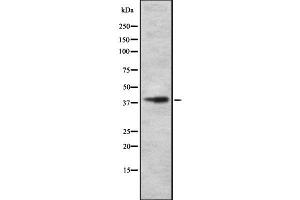 Western blot analysis SLC30A8 using MCF7 whole cell lysates (SLC30A8 antibody  (Internal Region))