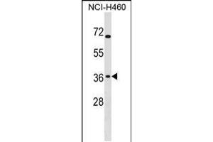 Western blot analysis in NCI-H460 cell line lysates (35ug/lane). (ST6GALNAC4 antibody  (C-Term))