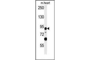 Western blot analysis of LRRC36 Antibody (N-term) in mouse heart tissue lysates (35ug/lane). (LRRC36 antibody  (N-Term))