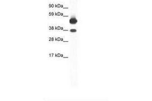 Image no. 1 for anti-Thyroid Hormone Receptor, beta (THRB) (AA 53-102) antibody (ABIN6736050) (THRB antibody  (AA 53-102))