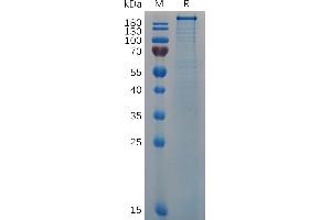 Human VWF (764-2813) Protein, His Tag on SDS-PAGE under reducing condition. (VWF Protein (AA 764-2813) (His tag))