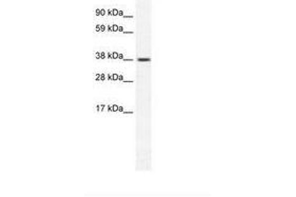 TRPM3 antibody  (AA 201-250)