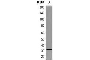 Western blot analysis of MYF5 expression in Jurkat (A) whole cell lysates. (MYF5 antibody  (Center))