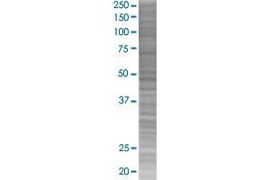 OSMR transfected lysate. (OSMR 293T Cell Transient Overexpression Lysate(Denatured))