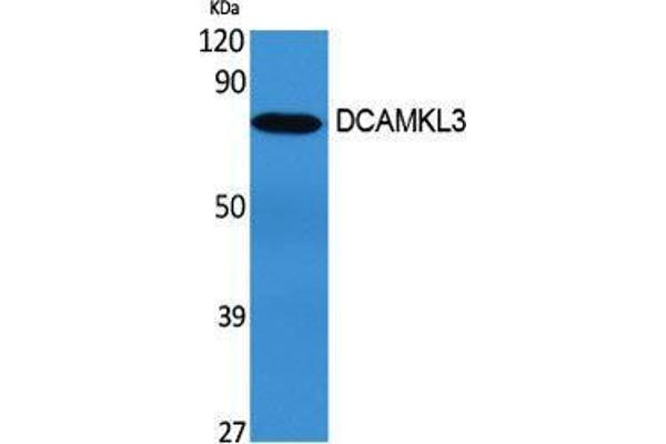 DCLK3 antibody  (Internal Region)