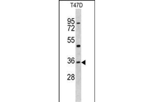 KLF6 antibody  (N-Term)