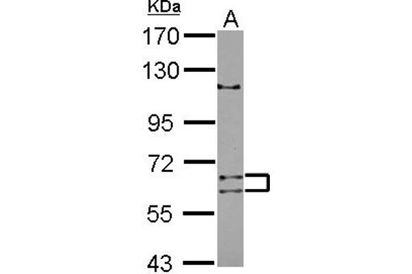 ADAD1 antibody  (AA 1-307)