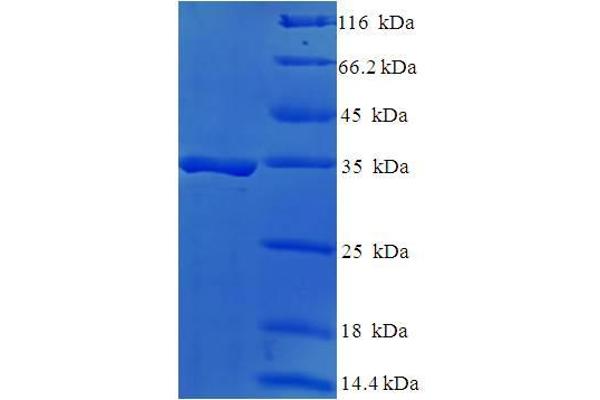 DAND5 Protein (AA 23-189) (His-SUMO Tag)