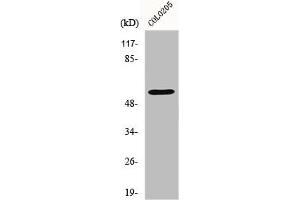 Western Blot analysis of COLO205 cells using Ikaros 3 Polyclonal Antibody (IKZF3 antibody  (Internal Region))