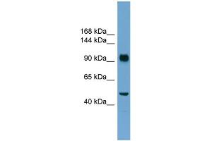WB Suggested Anti-RB1  Antibody Titration: 0. (Retinoblastoma 1 antibody  (N-Term))