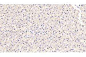 Detection of F2 in Rat Liver Tissue using Polyclonal Antibody to Coagulation Factor II (F2) (Prothrombin antibody  (AA 44-200))