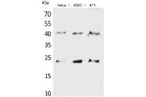 Western Blot analysis of hela, K562, 4T1 cells using TMEM173 Polyclonal Antibody. (STING/TMEM173 antibody  (C-Term))