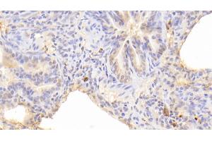 Detection of RAGE in Human Lung Tissue using Polyclonal Antibody to Receptor For Advanced Glycation Endproducts (RAGE) (RAGE antibody  (AA 91-274))