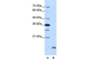 Western Blotting (WB) image for anti-Cyclin B3 (CCNB3) antibody (ABIN2461962) (Cyclin B3 antibody)