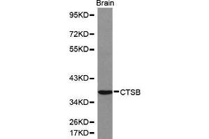 Western Blotting (WB) image for anti-Cathepsin B (CTSB) (AA 1-339) antibody (ABIN3021176) (Cathepsin B antibody  (AA 1-339))
