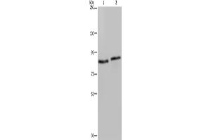Western Blotting (WB) image for anti-Integrin beta 2 (ITGB2) antibody (ABIN2430321) (Integrin beta 2 antibody)