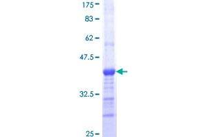 Image no. 1 for Lymphocyte Antigen 9 (CD229) (AA 156-253) protein (GST tag) (ABIN1309915) (LY9 Protein (AA 156-253) (GST tag))