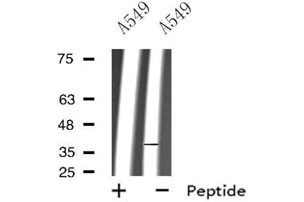 Rho-related GTP-binding protein anticorps