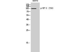 Western Blotting (WB) image for anti-Eukaryotic Translation Elongation Factor 2 (EEF2) (pThr56) antibody (ABIN5958636) (EEF2 antibody  (pThr56))