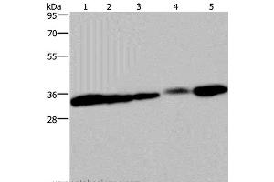 Western Blot analysis of HUVEC and 293T cell, Mouse bladder, Human placenta and Mouse kidney tissue using Claudin 23 Polyclonal Antibody at dilution of 1:200 (Claudin 23 antibody)