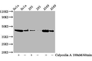 Western Blot Positive WB detected in Hela whole cell lysate,293 whole cell lysate,A549 whole cell lysate(treated with Calyculin A or not) All lanes Phospho-GSK3B antibody at 0. (Recombinant GSK3 beta antibody  (pSer9))
